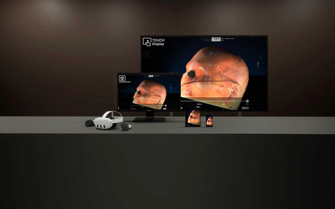 Medical dataset shown on a touch display, stereoscopic monitor, and mobile devices alongside a VR headset