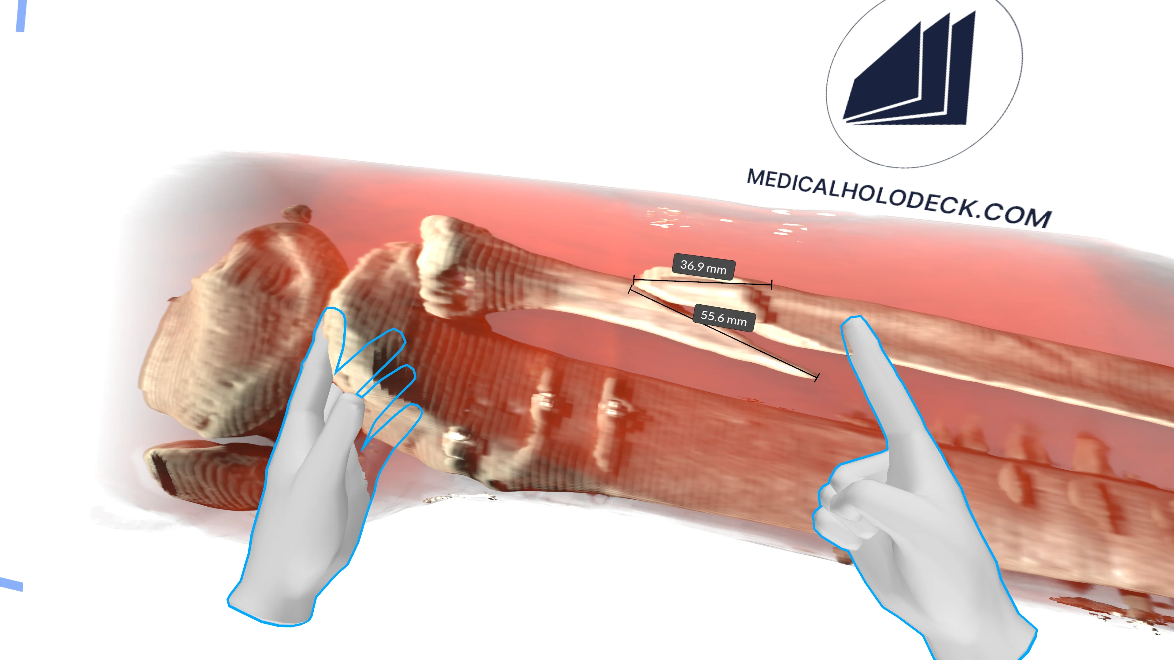 Imagem espacial Medicalholodeck exibida em uma tela grande e dispositivos complementares.