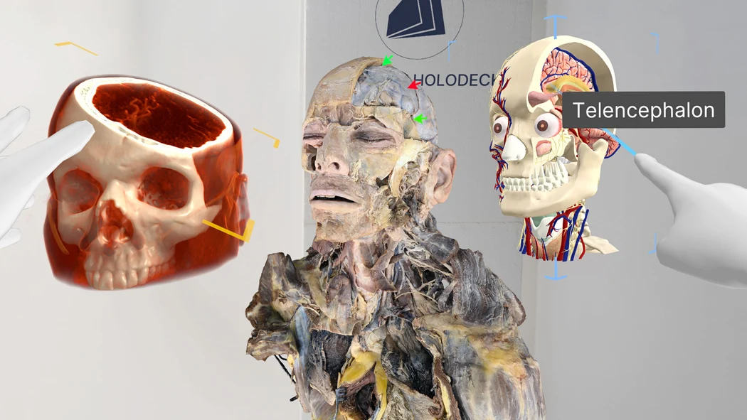 Renderização da cabeça CT exibida ao lado do conteúdo da dissecção humana e um modelo anatômico rotulado.