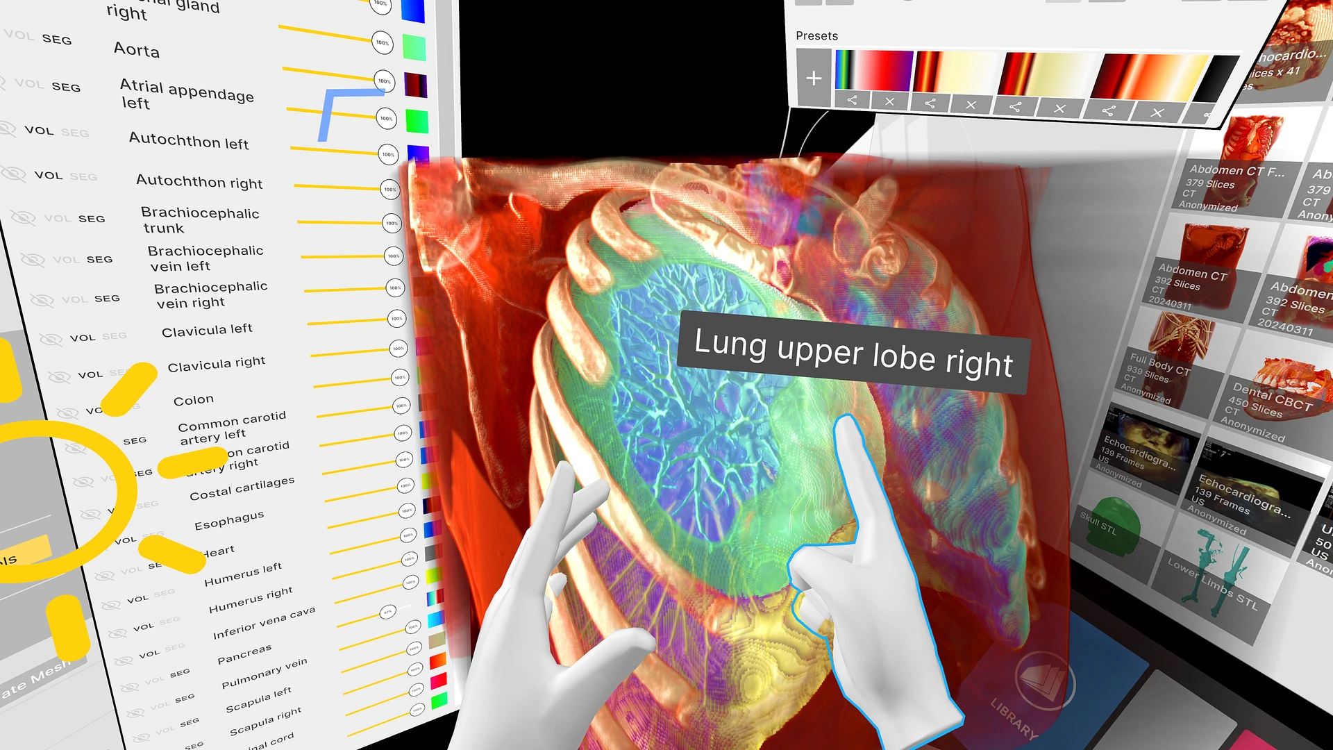 Segmented lungs in the Medicalholodeck VR interface with virtual hands and anatomical structure controls
