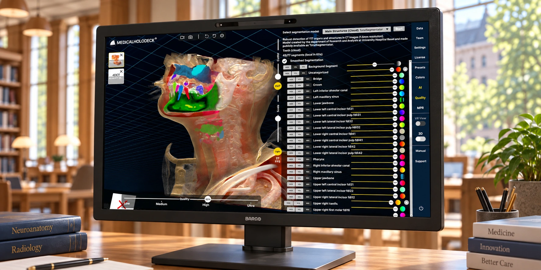 Illustration of a Barco Eonis 3D display showing dental AI segmentation in Medicalholodeck.