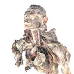Kopf und Thorax