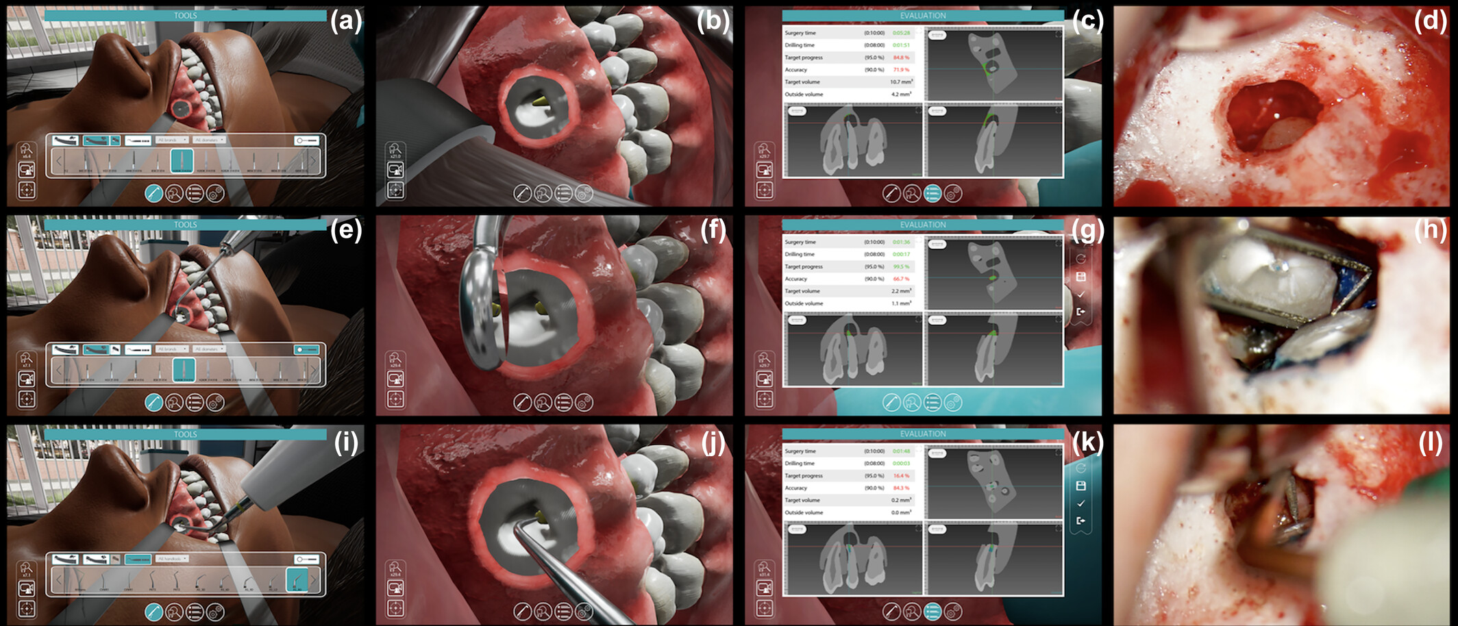 Endodontic training