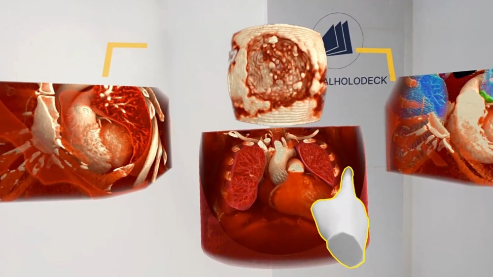Heart anatomy displayed in Medicalholodeck