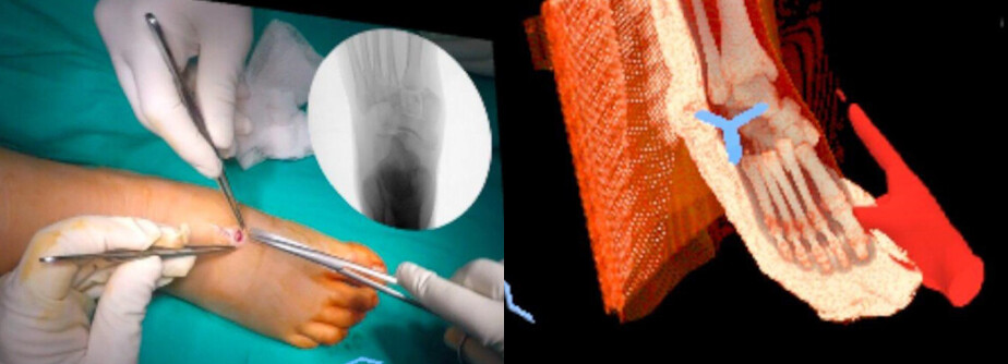 Intraoperative guidance