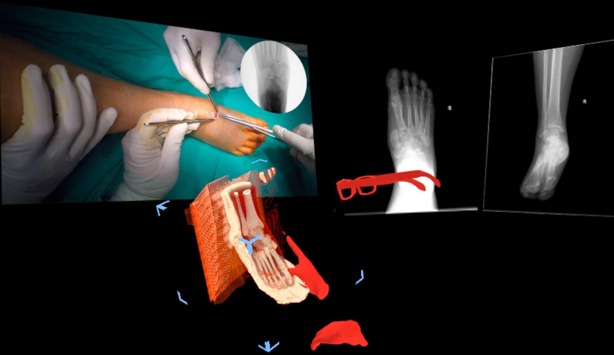 Intraoperative guidance