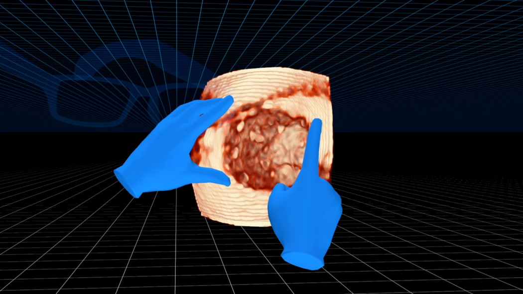 3D cardiac imaging example