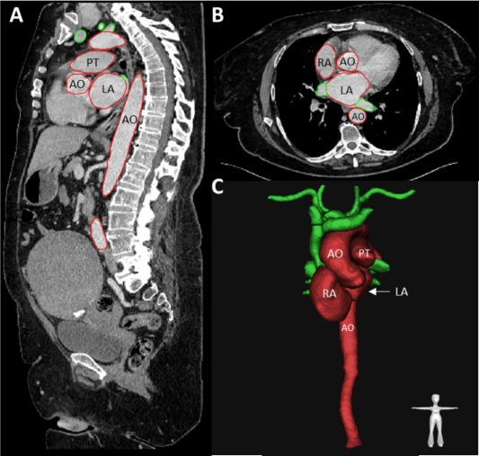 Segmentation results