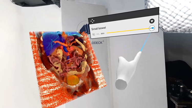 Gastrointestinal anatomy visualized in 3D