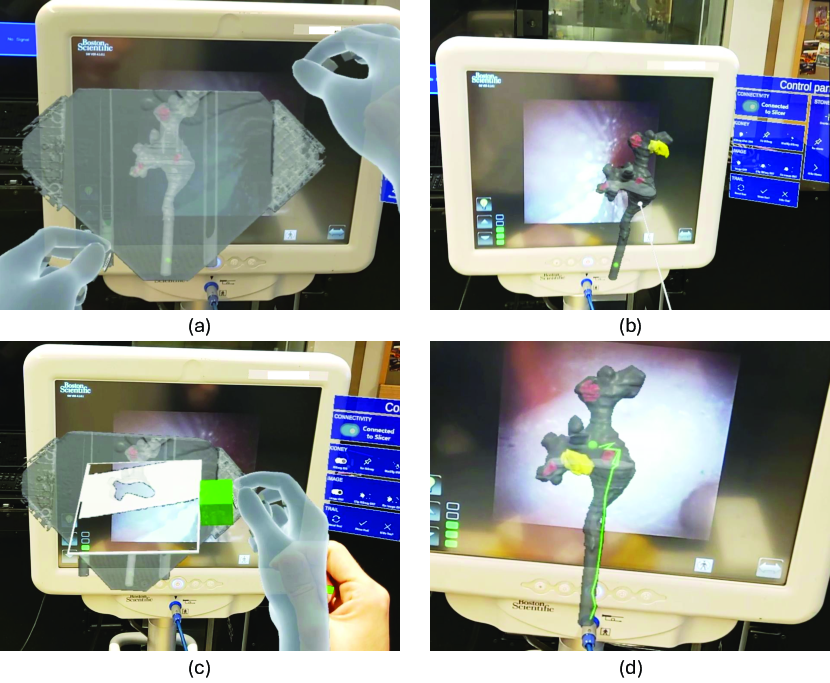 Ureteroscopy navigation