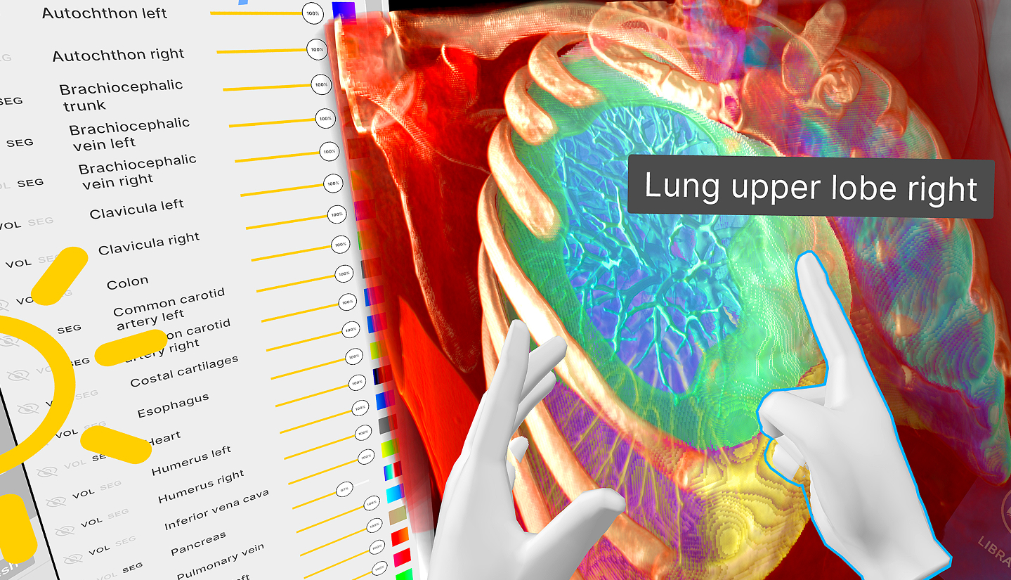 Medicalholodeck AI - Medical imaging and segmentation