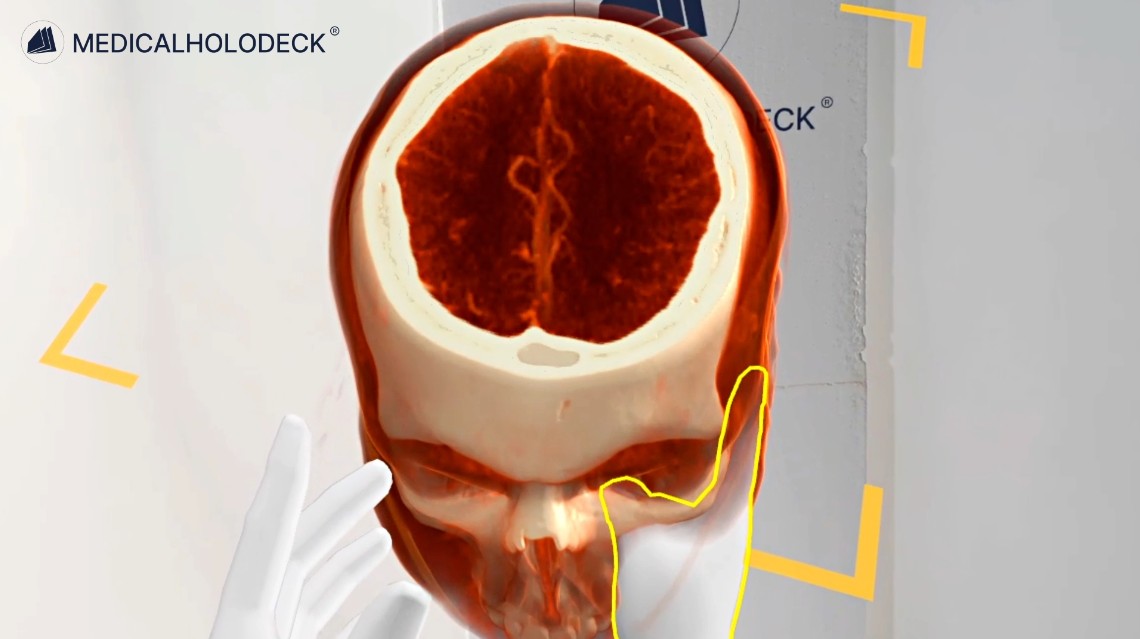 Medical imaging data displayed in 3D