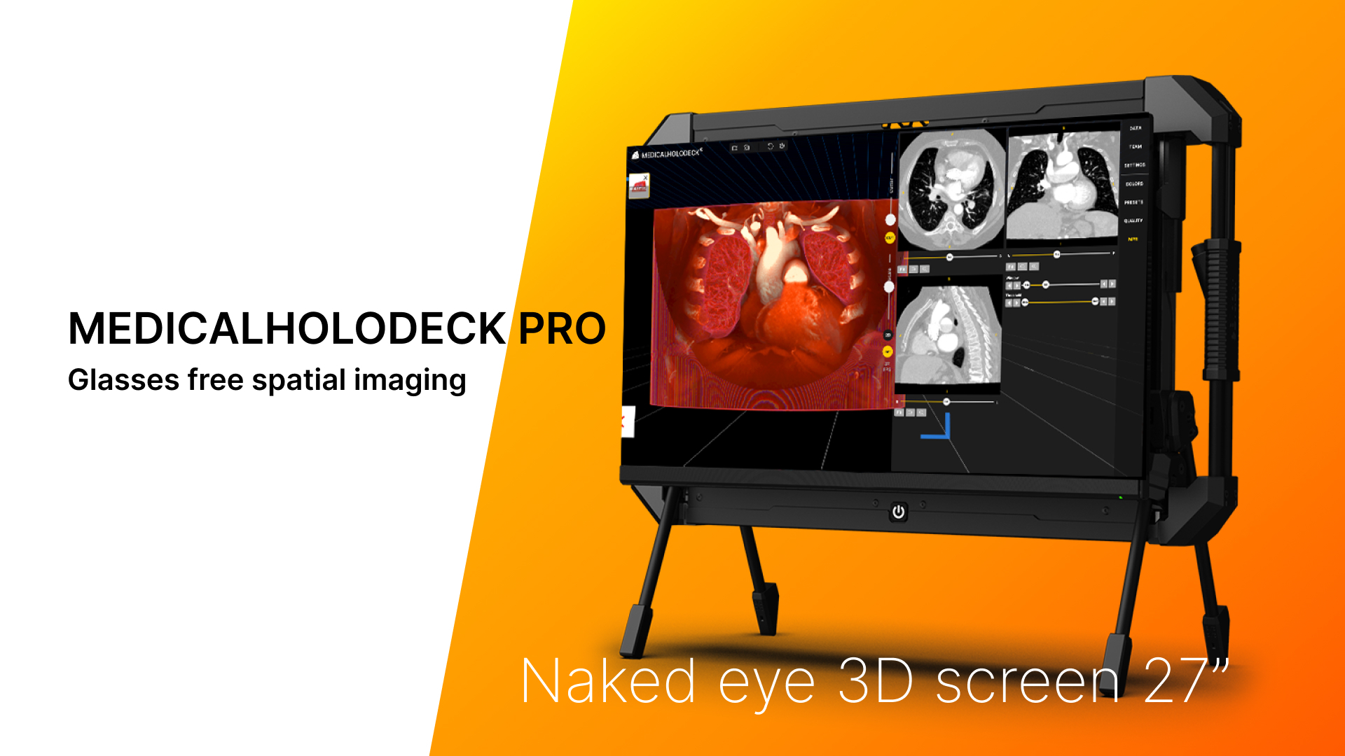 3D screens: The next level of immersion