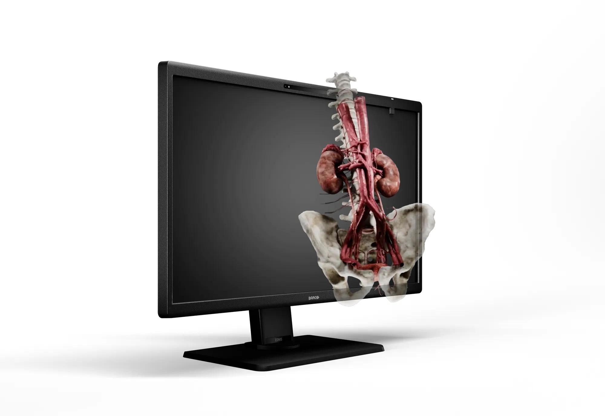 Barco Eonis 3D