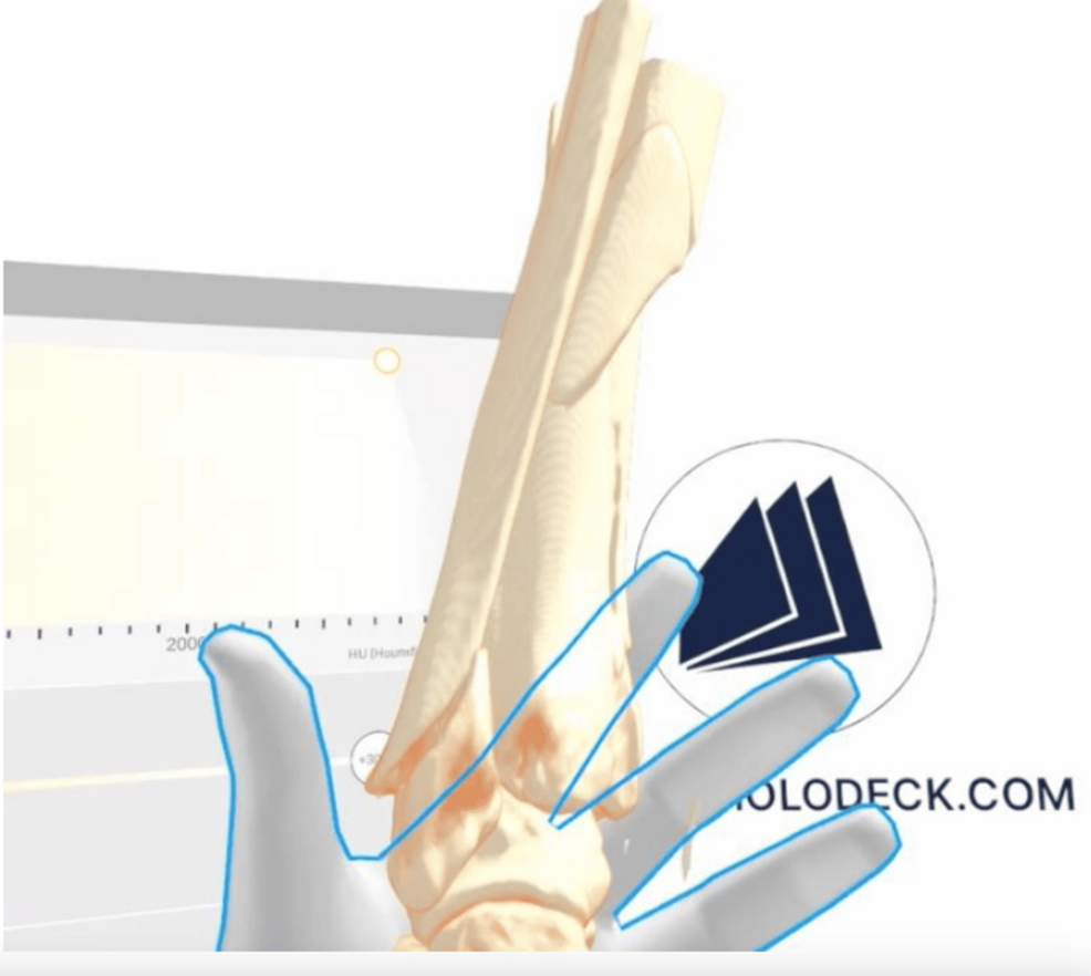 Challenges in bone fracture care
