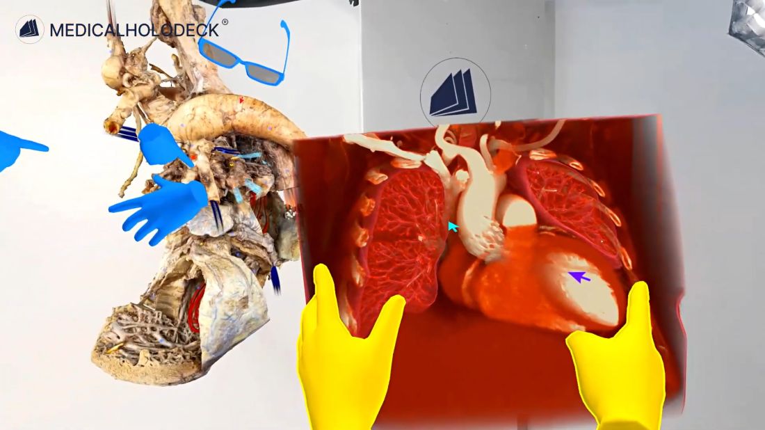 VR collaboration for thoracic surgery students