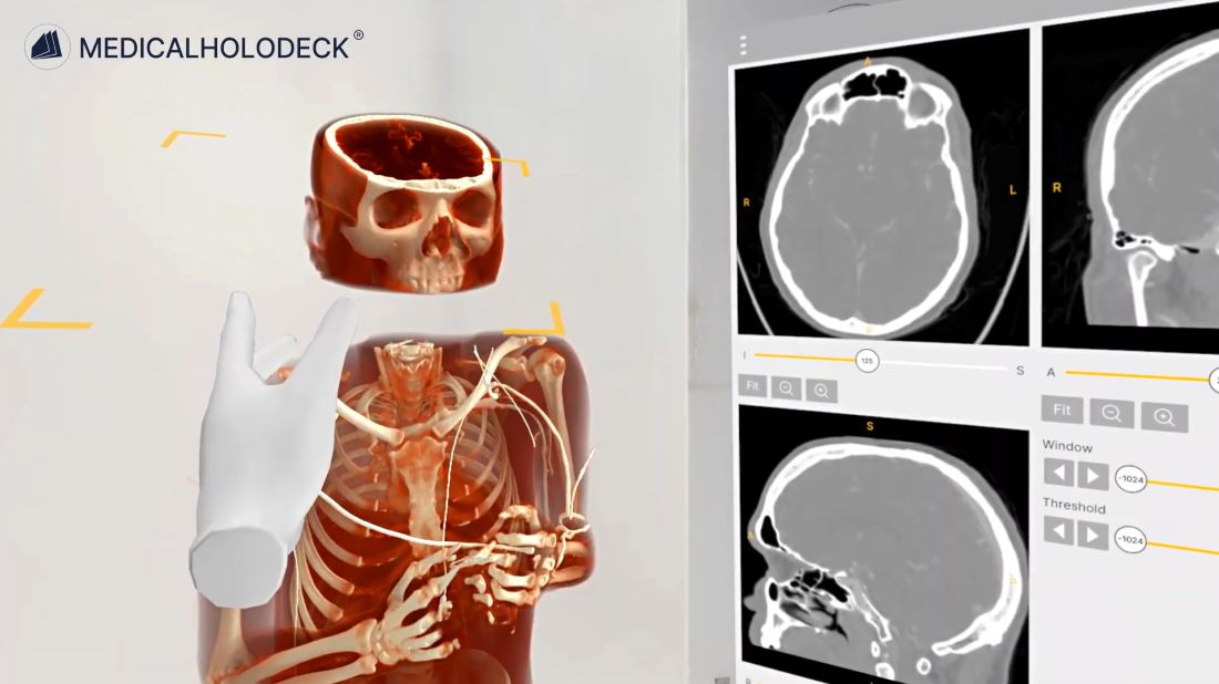 Enhancing preoperative orthopedic planning