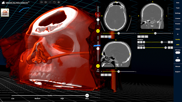 Spatial skull