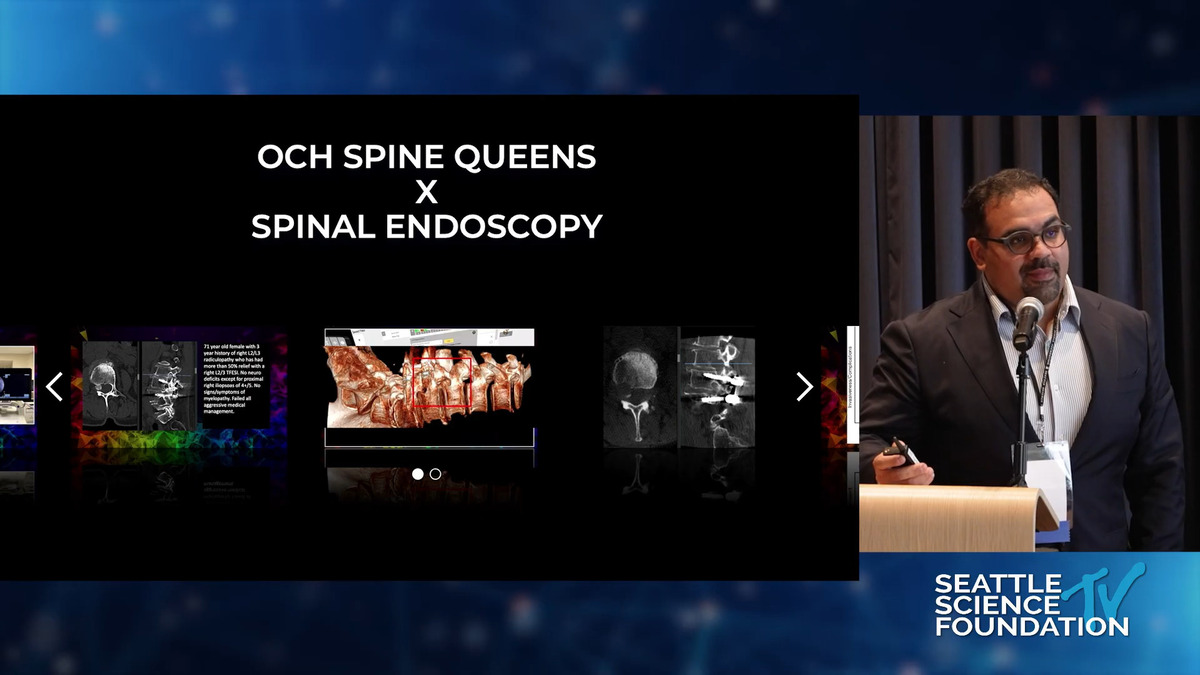 Spatial computing for minimally invasive spine surgery