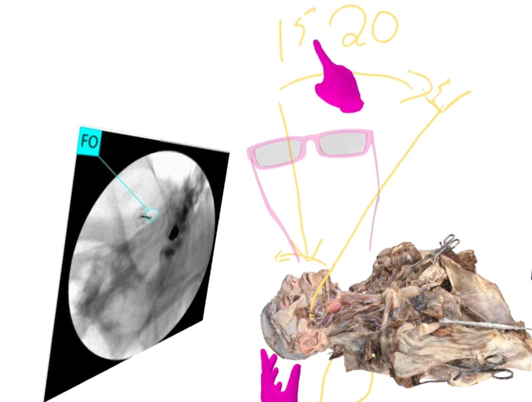 A wide spatial lesson view showing fluoroscopy, the approach angle, the instructor avatar, and cadaveric anatomy.