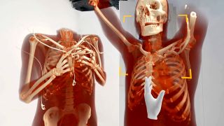Jumeaux numériques en XR médicale