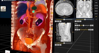 ハンブルクで開催されるDRUS 2025でのMedicalholodeck