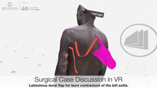 Collaboration chirurgicale mondiale en réalité virtuelle