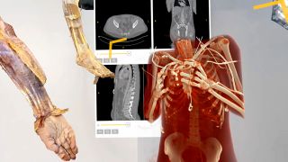 news.allArticles.orthopedics.title
