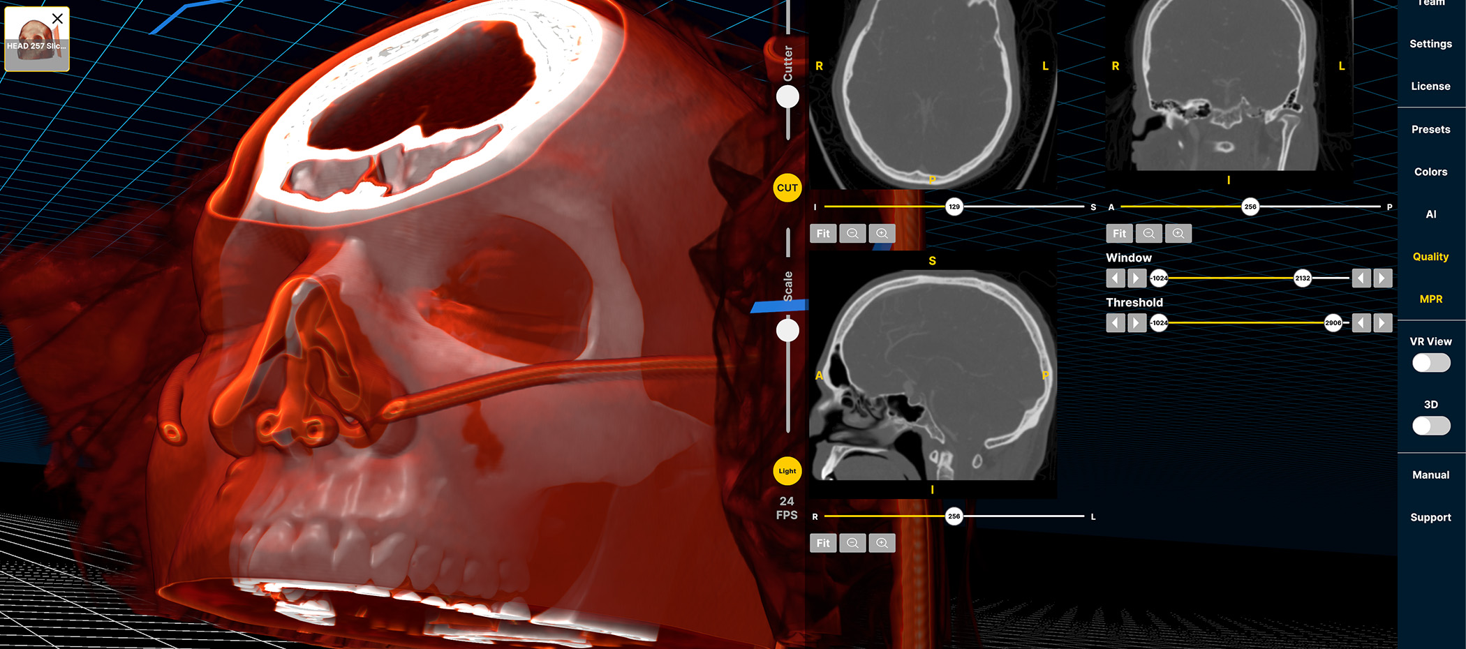 Tất cả trong một: VR, màn hình lập thể và màn hình tiêu chuẩn trên một máy tính