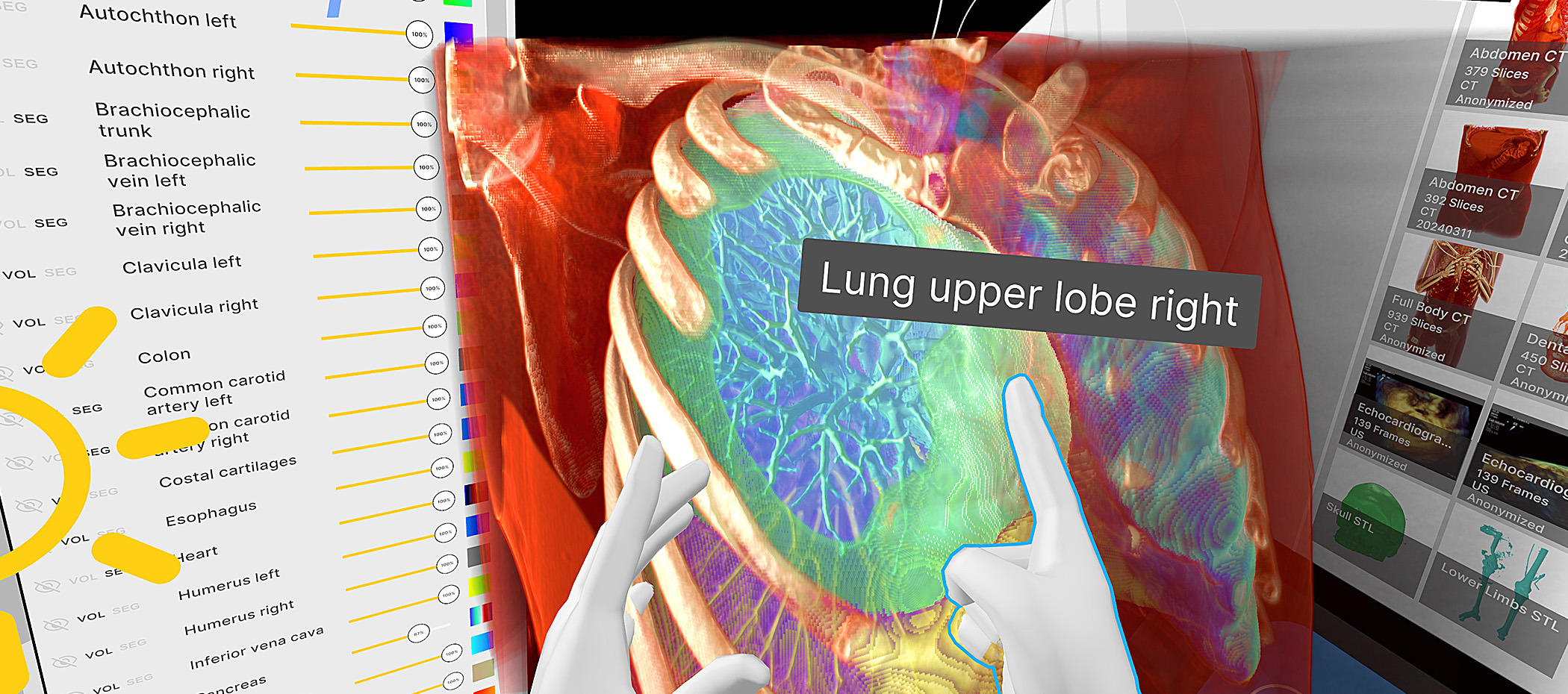 3D nâng cao: trực quan hóa không gian cho xem xét ca bệnh, thảo luận và đào tạo