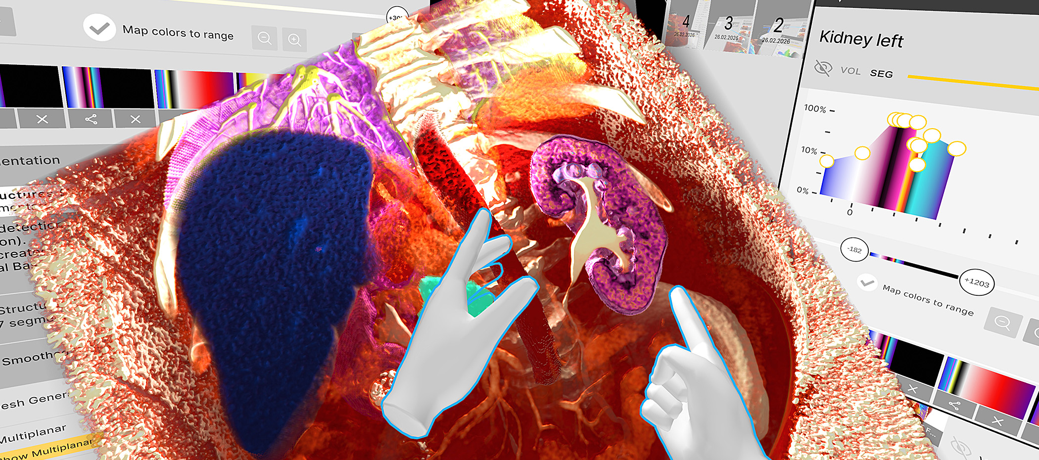 Nhanh, chính xác, an toàn: phân đoạn cục bộ, PACS và bảo mật tuân thủ HIPAA