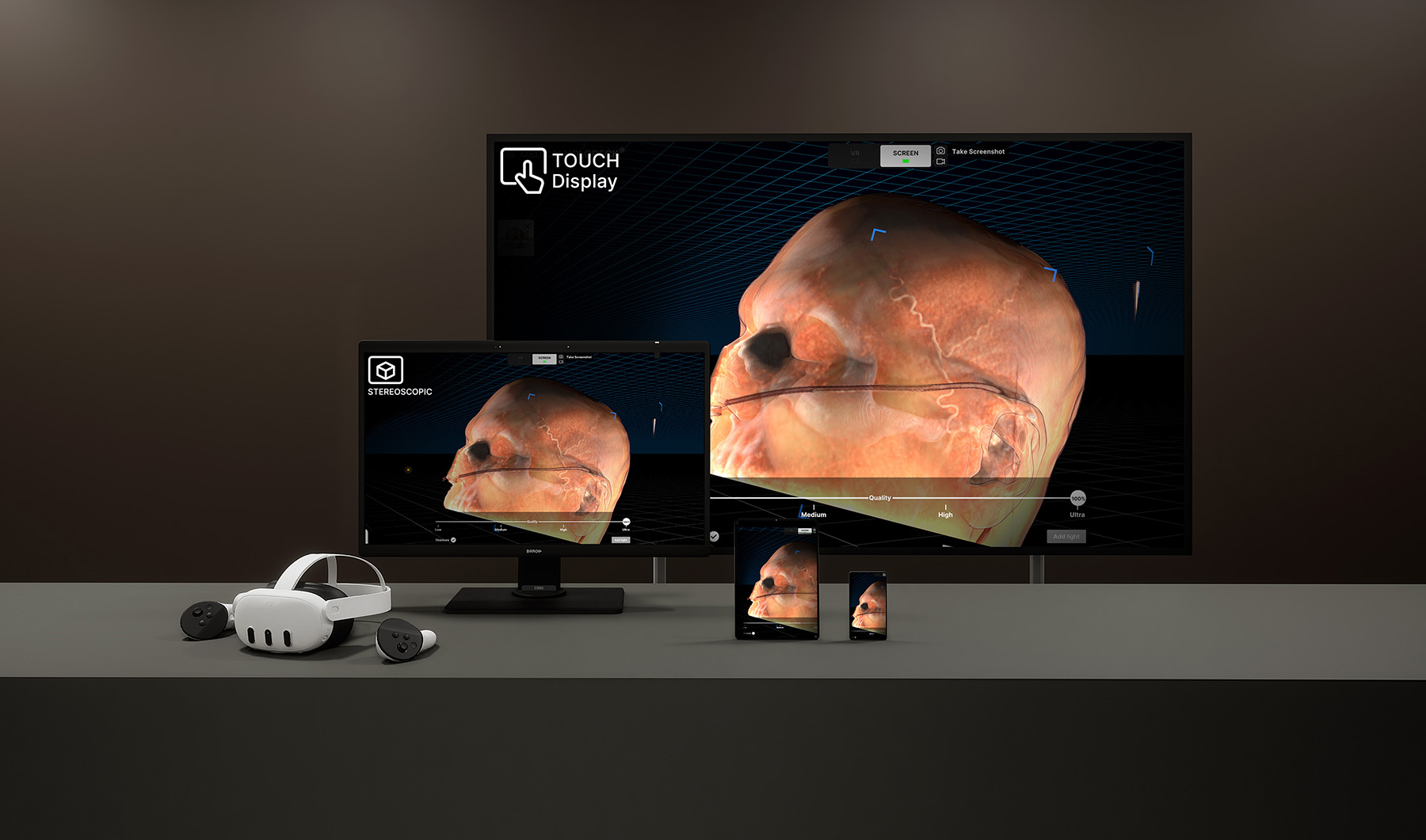 Spatial OS displaying the same head scan on a touch display, a stereoscopic monitor, smaller screens, and a VR headset