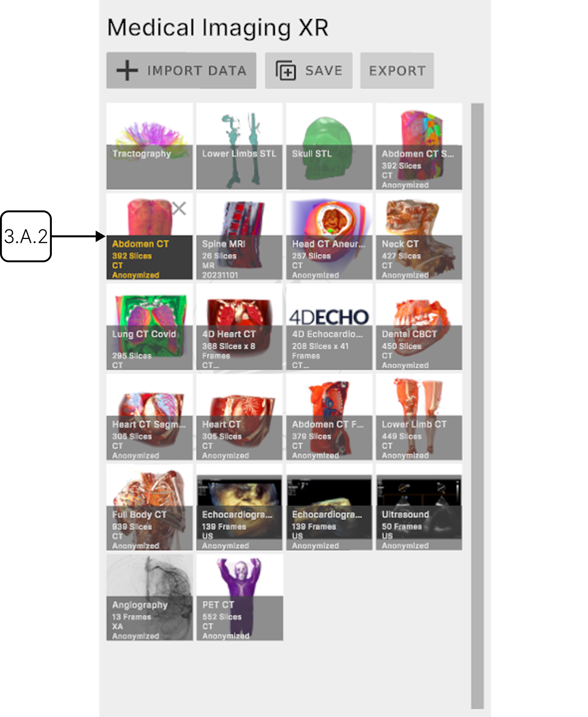 Running AI segmentation