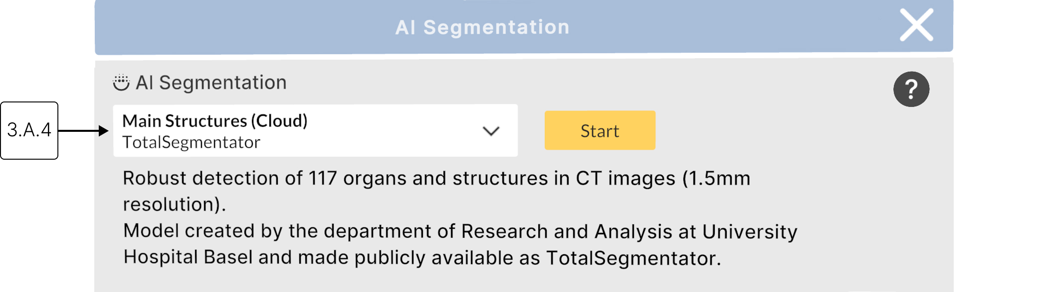 Choosing an AI Model