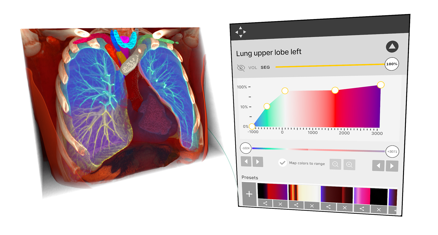 Segmentation controls