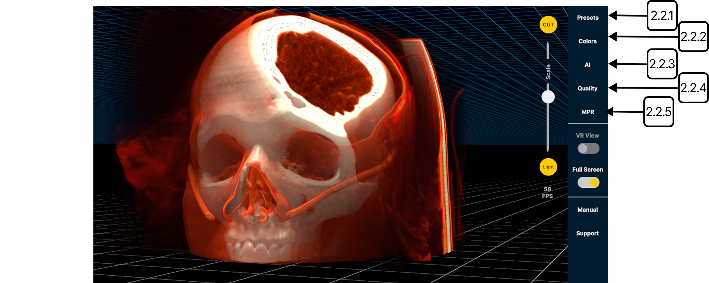 Editing and viewing DICOM data