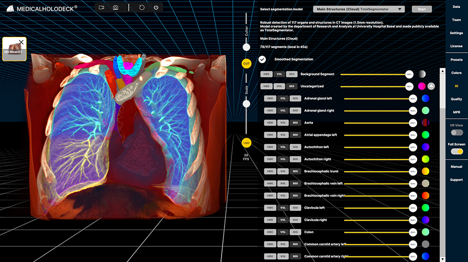 Segmented data